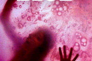 The Blob